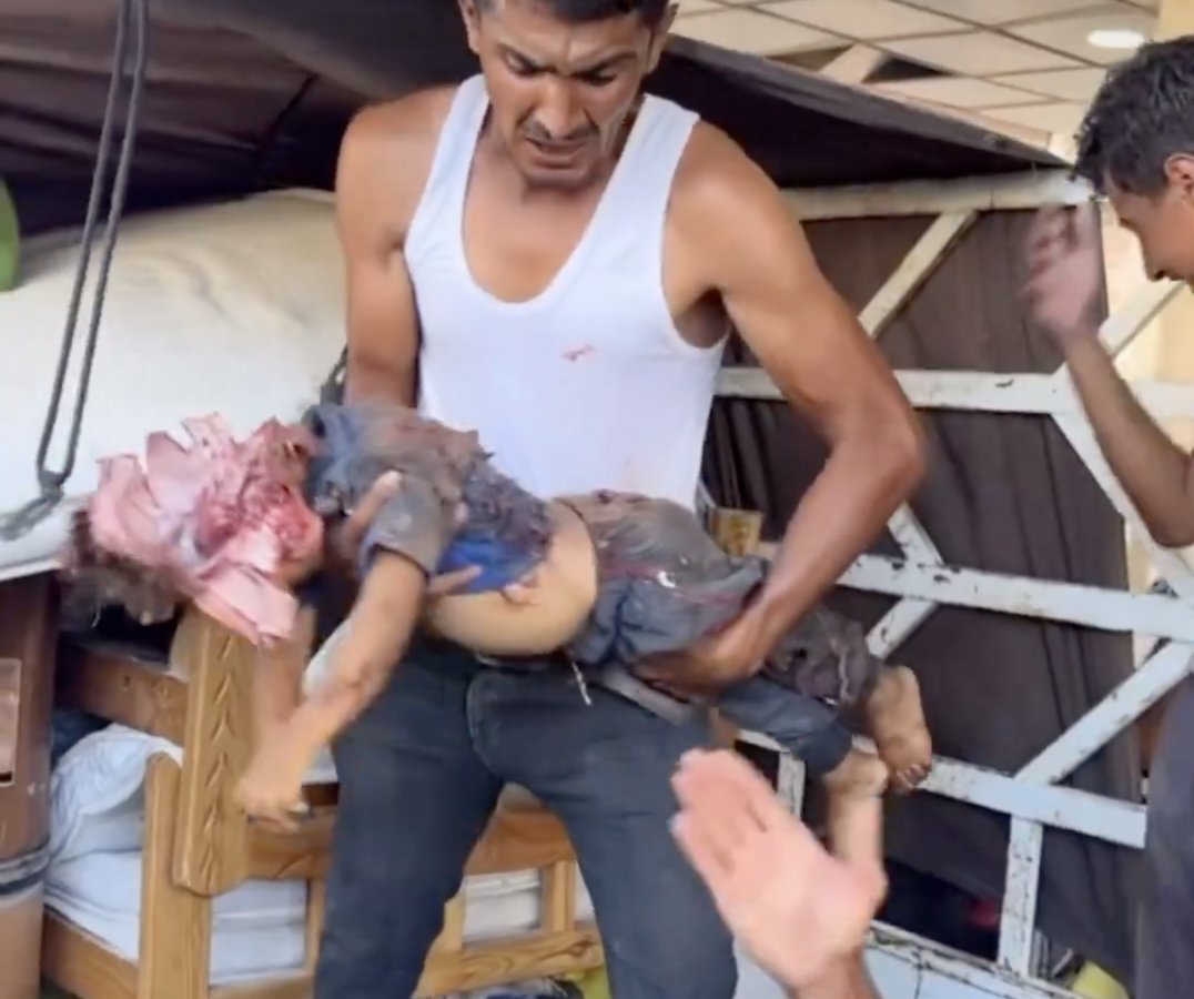 Un enfant tué par un bombardement de l'armée israélienne - D.R.