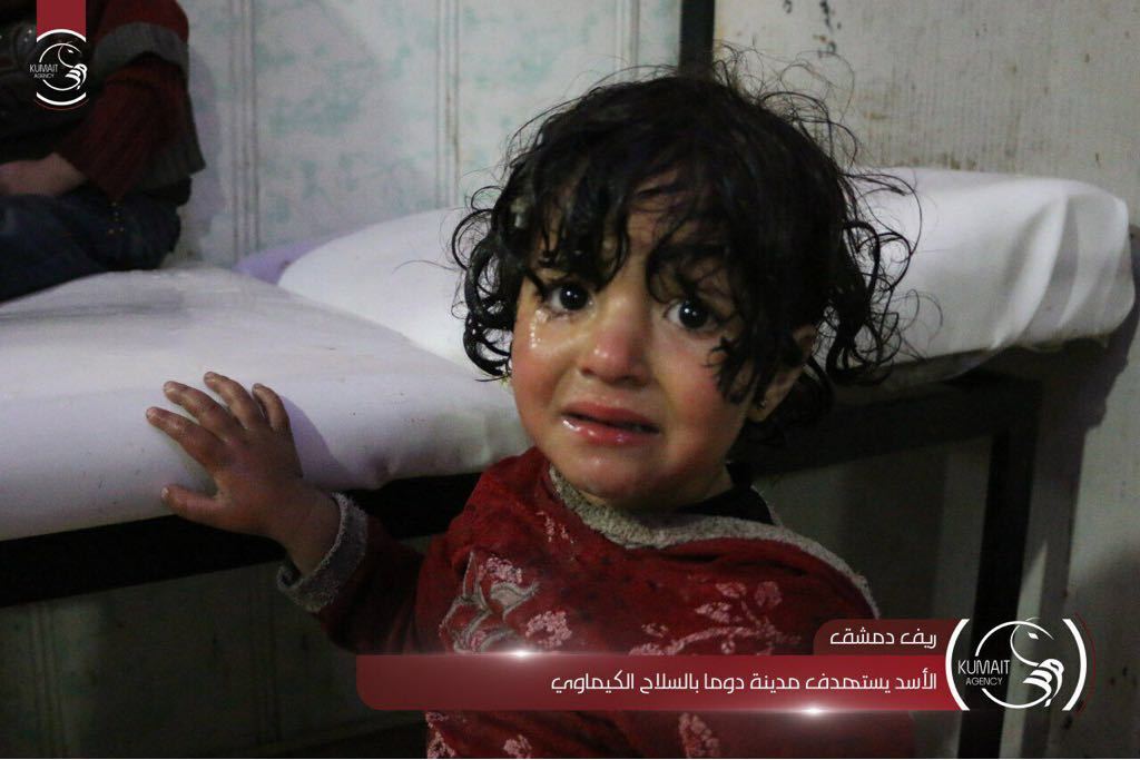 Enfant traité après le bombardement - D.R.