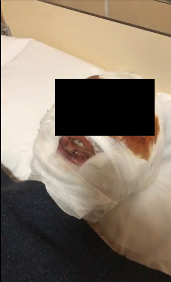 Ce prisonnier, visiblement soigné dans un hôpital a, dans cette vidéo, le visage bandé.