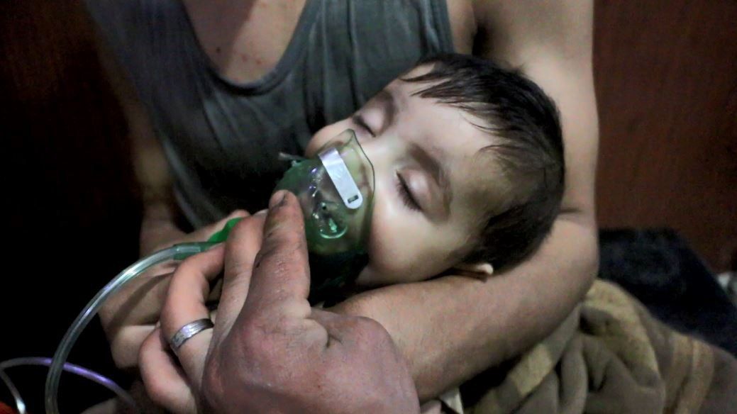 Enfant traité après le bombardement - D.R.